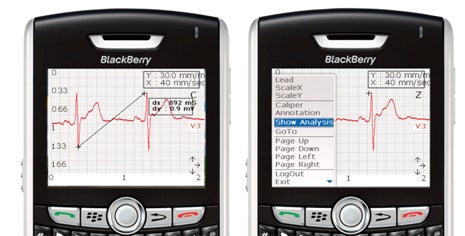 mVisum for BlackBerry EKG Screen Shots