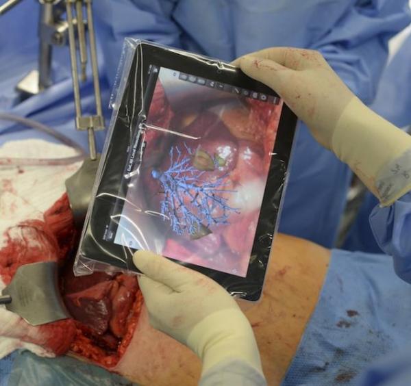 image_ipad_leber_op.jpg