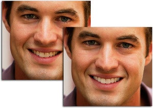 teeth hero