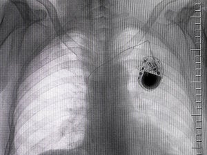Medical devices at risk: 5 capabilities that invite danger