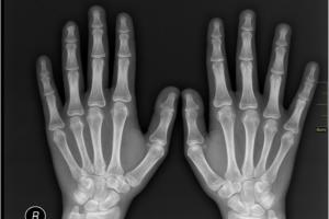 X-ray your SaaS apps to reveal hidden security vulnerabilities