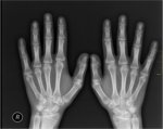X-ray your SaaS apps to reveal hidden security vulnerabilities