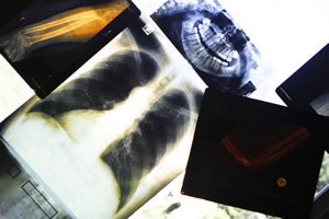 Biosurveillance plan allows feds to track Americans' health
